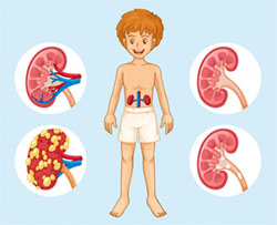 Kidney Replacement Therapy in COVID-19 Induced Kidney Failure and Septic Shock: A Pediatric Continuous Renal Replacement Therapy [PCRRT] Position on Emergency Preparedness With Resource Allocation